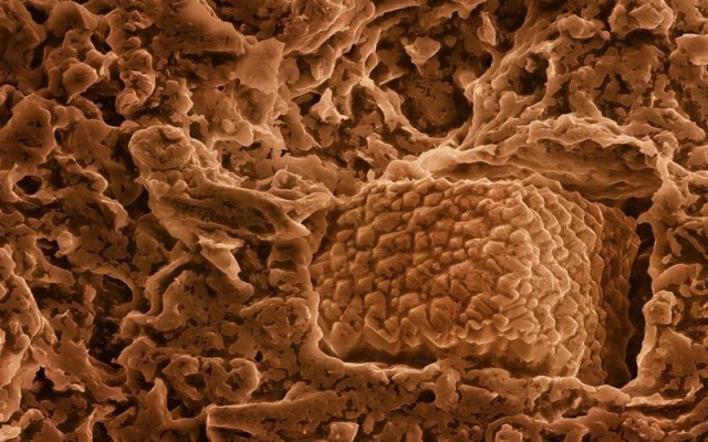 Fotos de alimentos no microscópio